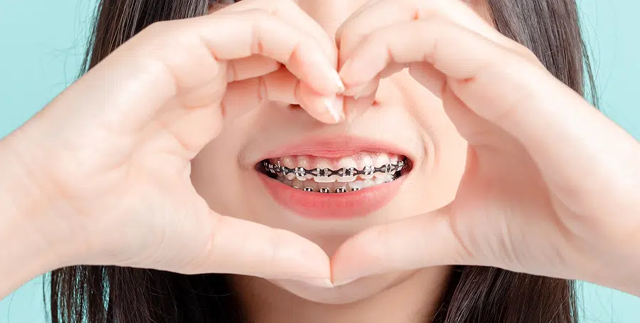 Ask Us About Life With Braces Today!