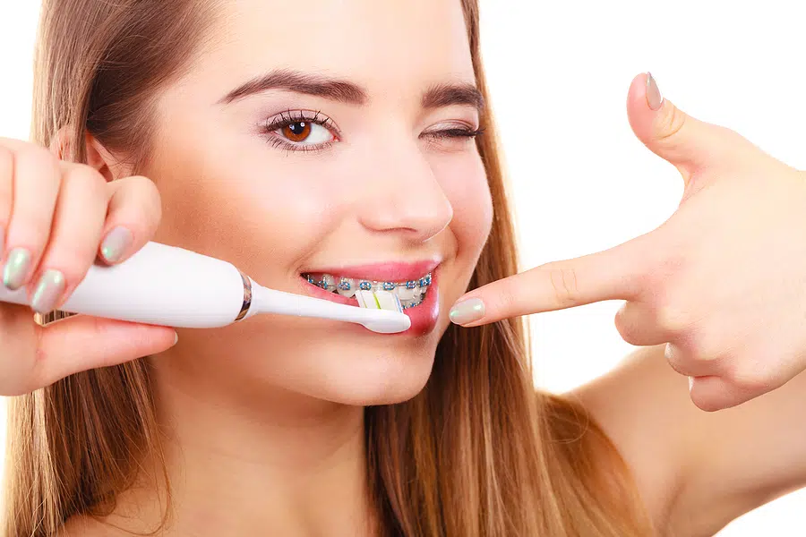 Oral Hygiene With Braces