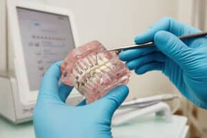 Invisalign vs. traditional braces
