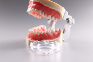 Retainers After Braces: Keeping Your New Smile the Right Way