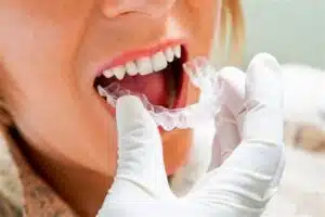 Invisalign Treatment Tips