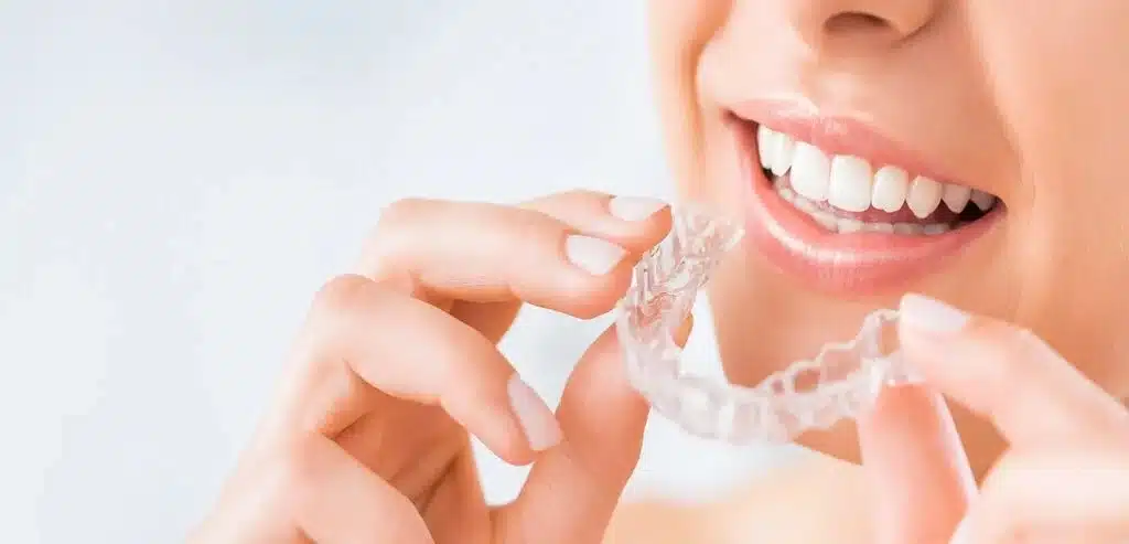 How Fast Does Invisalign Work? | Palo Alto Orthodontics
