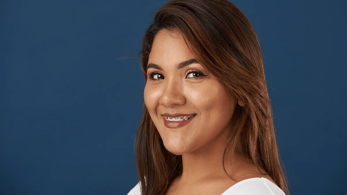 Adult Braces Options In Palo Alto Ca